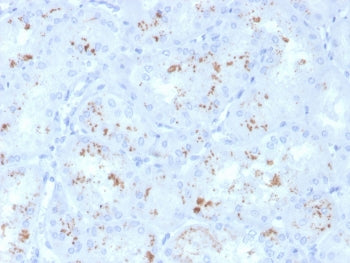 Retinol Binding Protein 4 Antibody / RBP4