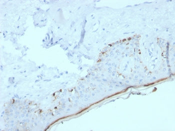 IHC staining of FFPE human skin with recombinant MART-1 antibody (clone MLANA/4385R). HIER: boil tis