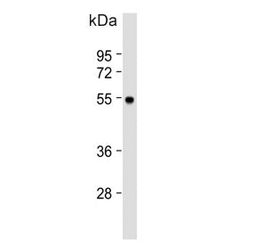 Western blot testing of human HL60 cell lysate with MCH Receptor 1 antibody. Expected molecular weig