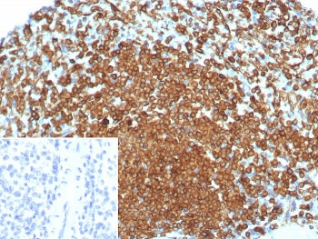 IHC staining of FFPE human spleen tissue with CD74 antibody (clone rCLIP/8679). Inset: PBS used in p