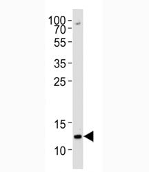 Western blot analysis of lysate from K562 cell line using H4 antibody diluted at 1:1000 for each lan