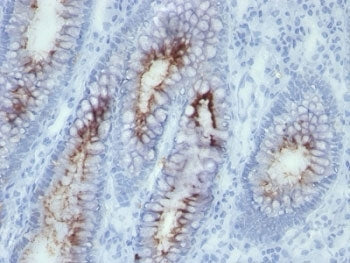 CEA Antibody / Carcinoembryonic Antigen