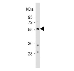 Western blot testing of human HEK293 cell lysate with Tryptophan Hydroxylase antibody. Predicted mol