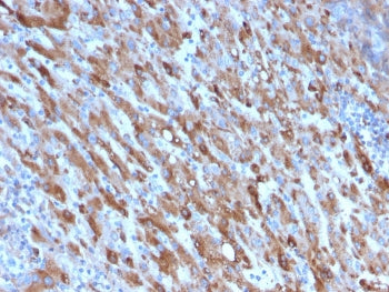 IHC staining of FFPE human liver with C1QA antibody. HIER: boil tissue sections in pH 9 10mM Tris wi