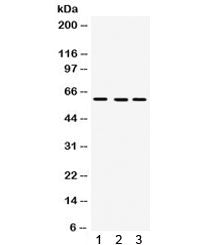 Western blot testing of 1) rat liver, 2) mouse liver and 3) human SMMC lysate with FMO3 antibody. Pr