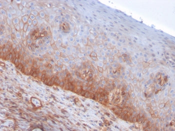 IHC staining of FFPE human cervix with Drebrin 1 antibody (clone DBN1/3393). HIER: boil tissue secti