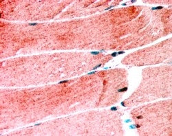 IHC testing of FFPE human skeletal muscle with MURF1 antibody at 1.25ug/ml. HIER: steamed with pH6 c