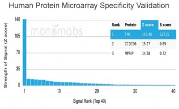 Analysis of HuProt(TM) microarray containing more than 19,000 full-length human proteins using Tyros