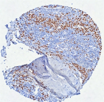 IRF4 Antibody / Interferon regulatory factor 4 / MUM-1