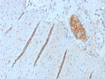IHC staining of FFPE human colon tissue with CD56 antibody (clone NCAM1/9074R). HIER: boil tissue se