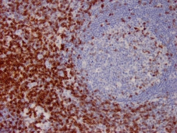 IHC staining of FFPE human lymph node with CD7 antibody. HIER: boil tissue sections in pH 9 10mM Tri