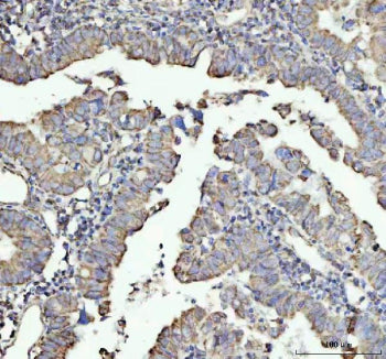 Immunohistochemical staining of NDUFAB1 using anti-NDUFAB1 antibody. NDUFAB1 was detected in a paraf
