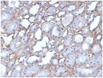 IHC staining of FFPE human kidney tissue with Collagen IV antibody (clone M3F7). HIER: boil tissue s