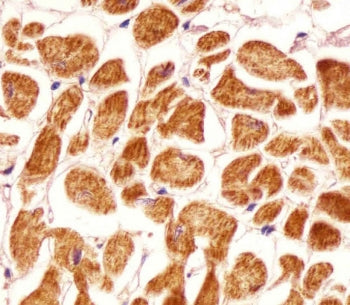 IHC testing of FFPE human heart tissue with PCCA antibody. HIER: steam section in pH6 citrate buffer
