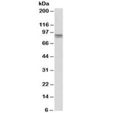 Western blot testing of human kidney lysate with E-Cadherin antibody at 0.5ug/ml. Expected molecular