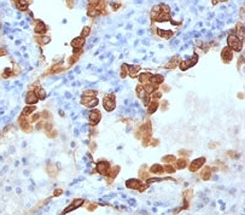 Cytokeratin 8/18 Antibody Cocktail