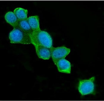 Immunofluorescent staining of FFPE human MCF7 cells with ATP Citrate Lyase antibody (green) and DAPI