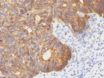 KRT8 Antibody / Cytokeratin 8