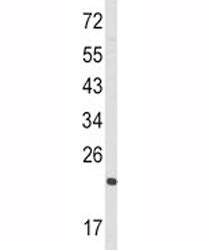 RAN Antibody