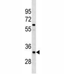XRCC4 antibody western blot analysis in A549 lysate. Predicted molecular weight: 35-38/55 kDa (unmod