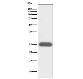 Western blot testing of human K562 cell lysate with G-CSF antibody. Predicted molecular weight ~22 k