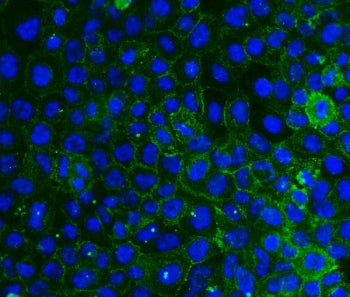 Integrin beta 4 Antibody / ITGB4 / CD104
