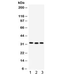C1QBP Antibody / GC1q R