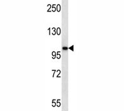AR antibody western blot analysis in ZR-75-1 lysate