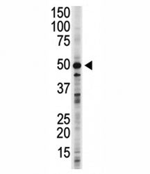 GSK3B Antibody