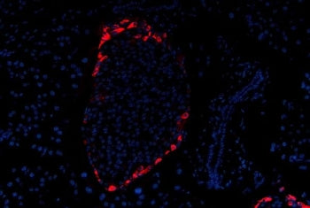 Immunofluorescent staining of FFPE mouse pancreas tissue with Glucagon antibody (red) and DAPI nucle