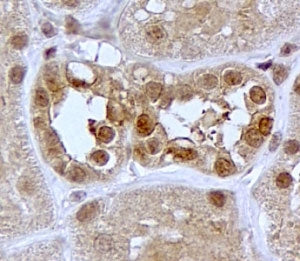 SGK1 Antibody