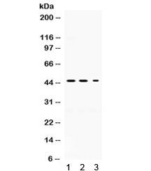 Western blot testing of 1) rat brain, 2) mouse brain, and 3) PANC lysate with Neuroserpin antibody. 
