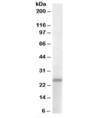 Western blot testing of human hippocampus lysate with PACAP antibody at 1ug/ml. Predicted molecular 