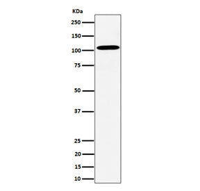 Western blot testing of human HepG2 cell lysate with USO1 antibody. Predicted molecular weight: ~108