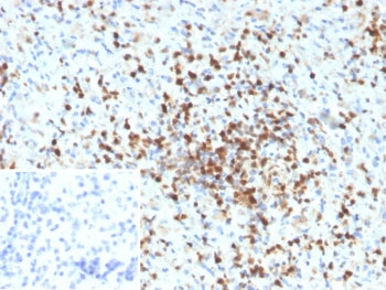 IHC staining of FFPE human spleen tissue with S100A4 antibody (clone S100A4/6797). Inset: PBS used i
