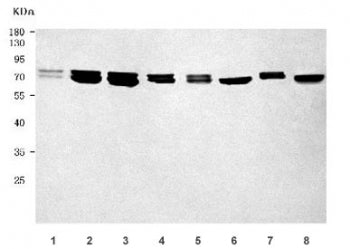 Western blot testing of 1) human placenta, 2) human U-87 MG, 3) human HepG2, 4) human T-47D, 5) rat 