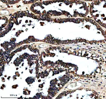 Immunohistochemical staining of FXN using anti-FXN antibody. FXN was detected in a paraffin-embedded
