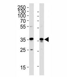 GAPDH Antibody