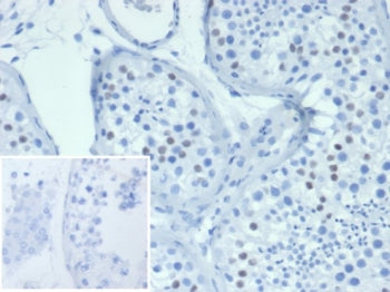IHC staining of FFPE human testis tissue with Wilms Tumor antibody (clone WT1/7450). Inset: PBS used