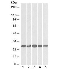 Western blot testing of 1) mouse NIH3T3 and human 2) HeLa, 3) K562, 4) MCF7 and 5) HepG2 lysates wit