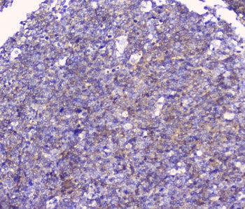 IHC staining of FFPE human tonsil tissue with CD32 antibody at 1ug/ml. HIER: boil tissue sections in
