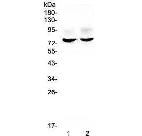 Western blot testing of 1) rat brain and 2) mouse brain lysate with KCNA1 antibody at 0.5ug/ml. Expe