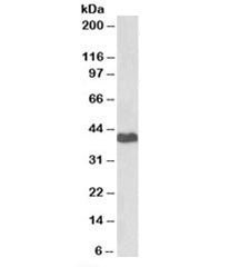 Western blot testing of human HeLa cell lysate with PRKACA antibody at 2ug/ml. Predicted molecular w