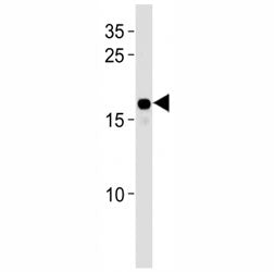 HMGA2 antibody western blot analysis in HepG2 lysate. Predicted molecular weight ~12kDa but routinel