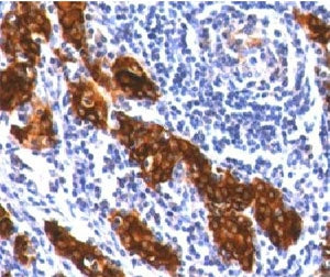 TG Antibody / Thyroglobulin