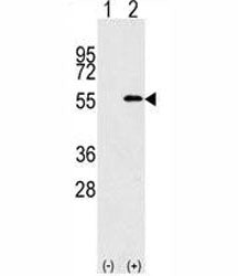 Western blot analysis of NUP50 antibody and 293 cell lysate (2 ug/lane) either nontransfected (Lane 