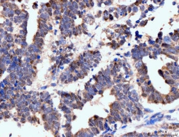 Neurofibromin Antibody / NF1