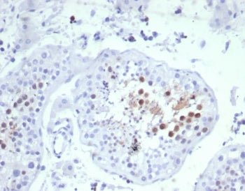 KIF2C Antibody / MCAK