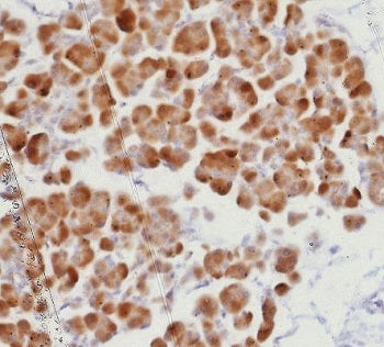 IHC staining of FFPE human pancreas tissue with recombinant ROR gamma antibody (clone RORC/8278R). H