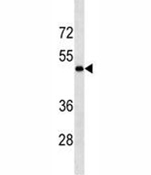 LOX antibody western blot analysis in MDA-MB231 lysate. Expected molecular weight: ~47 kDa (unproces